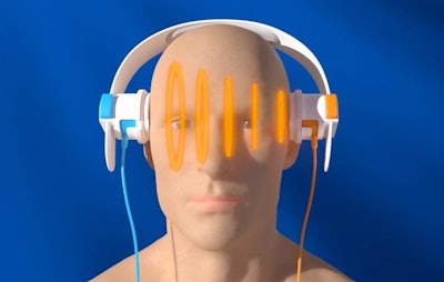 With the SONAS device, patients wear 'headphones' that transmit sound waves to analyze harmonic signals from ultrasound contrast in the brain to detect stroke. Image courtesy of BURL.