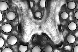 2019 01 15 01 44 4393 3 D Printed Implant 20190115013502