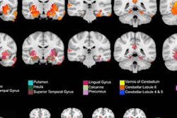 2019 01 15 02 52 0671 Mri Cannabis Brain Effex 20190115024306
