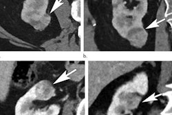 2019 01 15 19 25 6386 Rsna Reaffirm Kidney 20190115191952