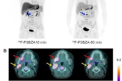 2019 01 17 00 50 4217 Jnm Melanin Pet Tracer 20190117001720