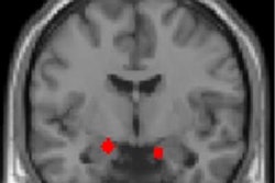 2019 01 29 00 53 1480 2019 01 29 F Mri Ptsd 20190129003910
