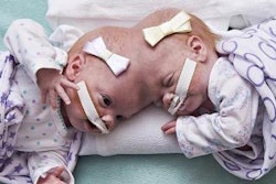 2019 01 29 00 55 2918 2019 01 29 Conjoined Twins 20190129002742