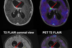 2019 01 29 19 14 7028 Pet Mri Pedx Jnm Marner 20190129195000