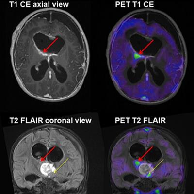 2019 01 29 19 14 7028 Pet Mri Pedx Jnm Marner 20190129195000