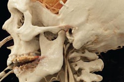 2019 02 04 23 41 3767 Cinemating Rend Calcification 20190204233136