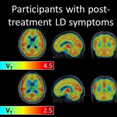 2019 02 05 23 18 6650 Pet Lyme Disease Jhu 400