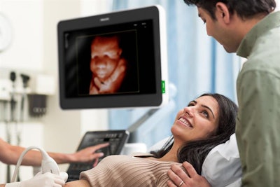 Philips' TrueVue technology enables clinicians to manipulate a virtual light source around 3D fetal images to produce lifelike images. Image courtesy of Philips.