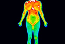 2019 02 16 00 06 2279 Thermography 400