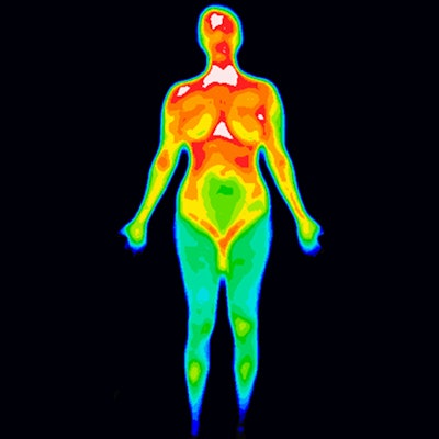 2019 02 16 00 06 2279 Thermography 400