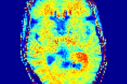 2019 02 26 23 56 2519 2019 02 27 Nh 1 Cest Thumb