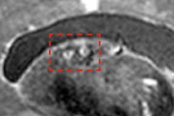 2019 02 27 22 27 4018 2019 02 28 7 T Mri2 20190301210846