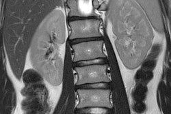 2019 02 27 23 15 0681 2019 02 28 Ge Mri3 20190227232703 20190227233753