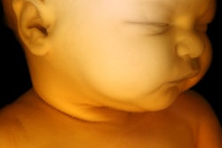 2016 10 12 11 02 26 66 Fetus Mri 400