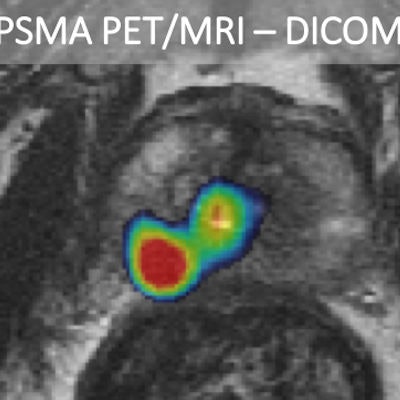 2019 02 28 22 32 4413 Pet Mri Biopsy Guidance 400 Thumb