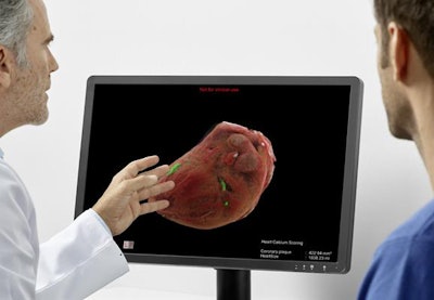 Designed to serve as an assistant for radiologists, Siemens' AI-Rad Companion Chest CT software identifies and measures organ lesions on chest CT images and automatically generates a quantitative report. Image courtesy of Siemens.