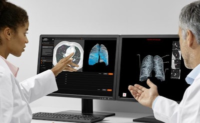 Chest CT scan viewed with the AI-Rad Companion Chest CT software. Image courtesy of Siemens Healthineers.