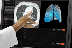 2019 03 02 00 49 9031 Siemens Ai Rad Ct 20190302005701