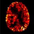 2019 03 02 21 51 4385 Esmrmb Figure 2 20190302220021