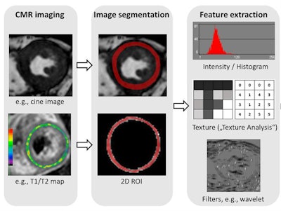 Radiomics in cardiac MR (CMR). Radiomic feature extraction can be performed on all types of MR images, such as cine images or T1/T2 maps. Image courtesy of Dr. Bettina Baeßler.