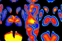 2019 03 04 18 37 3817 Nih Brain 20190304211628