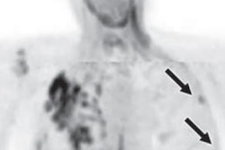 2019 03 08 23 08 1963 Pet Ct Opscc Single Image A D 20190308233337