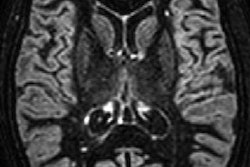 2019 03 12 00 36 6048 Mri Ms Contrast Comparisons Rad 20190312003843