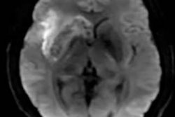 2019 03 12 16 16 5349 R2 Iron Deposits Mri Linck 20190312170158