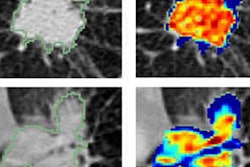 2019 03 19 22 56 0891 Radiology Ai 20190319223549