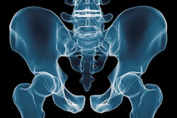 2017 05 04 15 25 57 306 X Ray Pelvis 400