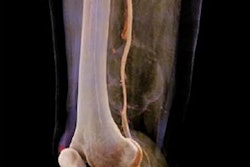 2019 03 29 21 42 5501 Cr Sarcoma 400