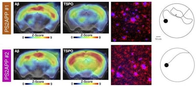 Images show the multimodal correlation analysis of cognitive testing with terminal PET and immunohistochemical results in mice at the end of the study. Representative PET images (z score on MRI template), immunohistochemistry (fused methoxy-X04 [blue] and Iba1 [red]), and white matter findings of individual mice show either low (orange) or high (magenta) markers of microglial activation at study termination. Images courtesy of Focke et al and J Nucl Med.