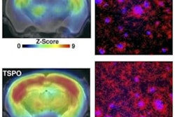 2019 04 05 16 22 1629 Tspo Pet Alzheimers Jnm 400