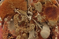 2019 04 05 21 44 7600 Cr Spleen Slide2 20190405215115