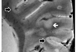 2019 04 09 00 17 6877 Ms 7 T Rad Mainero 400