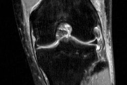 2019 04 09 18 17 0158 Acl Mri Insider April 08 20190409181730