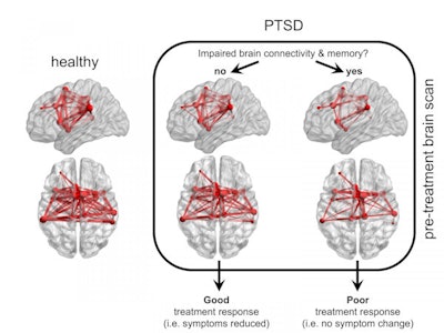 Functional MR images compare connectivity of the brain's VAN (red) in healthy individuals and patients with PTSD, and show how connectivity and memory ability are either impaired or not. Images courtesy of Adi Maron-Katz, PhD.