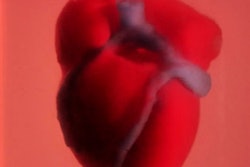 2019 04 15 23 53 6527 3 D Bioprinted Heart 400