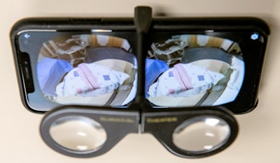 Stereoscopic viewer attached to a smartphone for visualizing augmented reality 3D models. Image courtesy of Dr. Raul Uppot.
