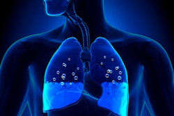 2019 04 19 22 55 2636 Lung Fluid 400