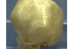 2019 04 19 23 07 0890 3 D Printed Skull 400