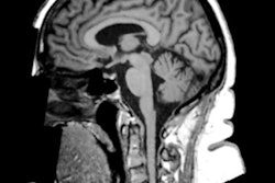 2019 04 22 23 48 5292 Mri Obesity Brain Changes Dekkers 400