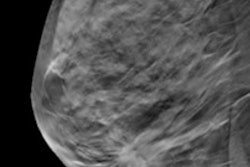 2017 04 11 16 10 08 814 Dbt Digital Breast Tomosynthesis 400