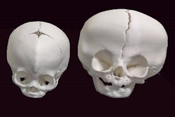 2019 05 06 17 40 8363 3 D Printed Skulls Resize 20190506172418