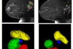 2019 05 14 17 37 5298 Ismrm Mri Lymph Nodes 400