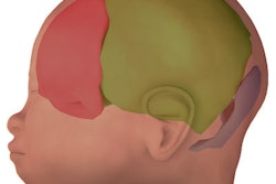 2019 05 14 23 37 1818 3 D Mri Brain 400