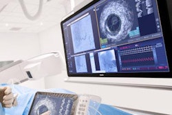 2019 05 20 19 27 7433 Philips Intra Sight 600 20190520190341