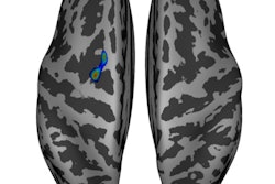 2019 05 20 23 52 5360 Ismrm Mri Pregnant Women 400