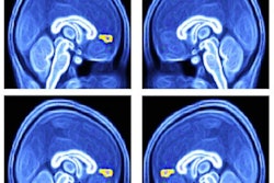 2019 05 21 23 08 3603 F Mri Autism Bio Psych 400