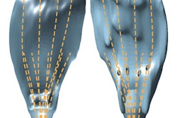 2019 05 22 21 33 2978 3 D Printing Brachytherapy 400